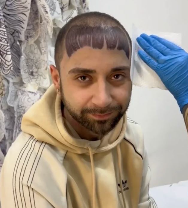 Balding man gets fringe tattoo to cover hairline, breaks down in tears at result 5