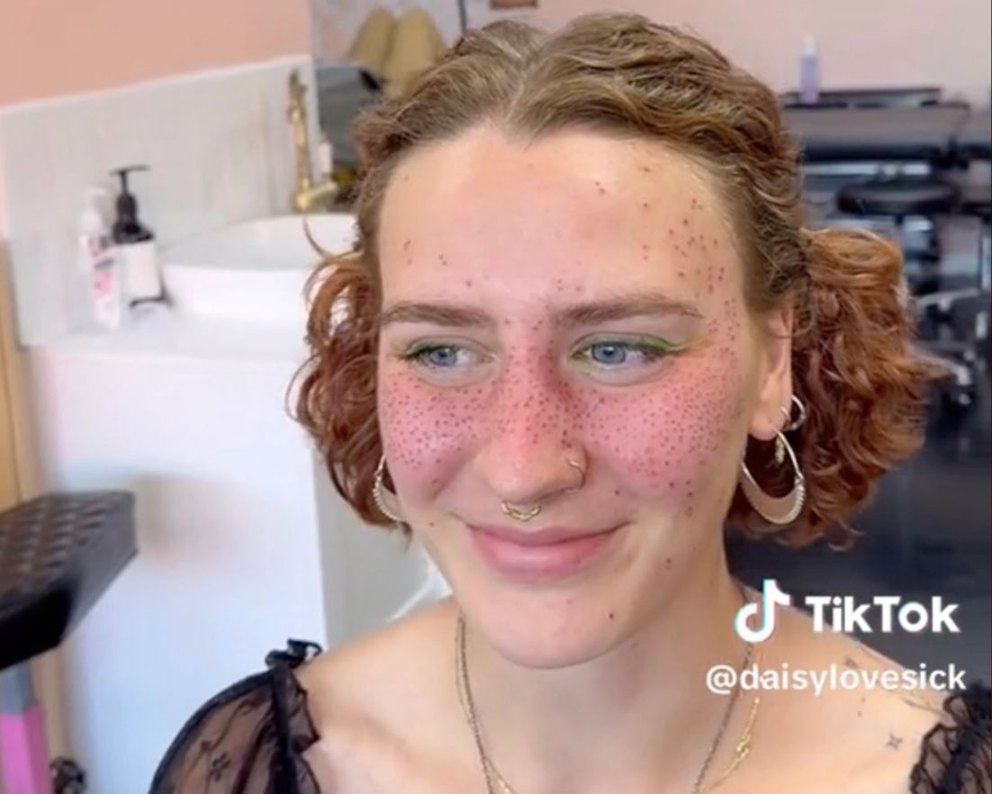 A woman gets fake freckles tattooed, with some predicting that they will 'age like a tramp stamp' 4