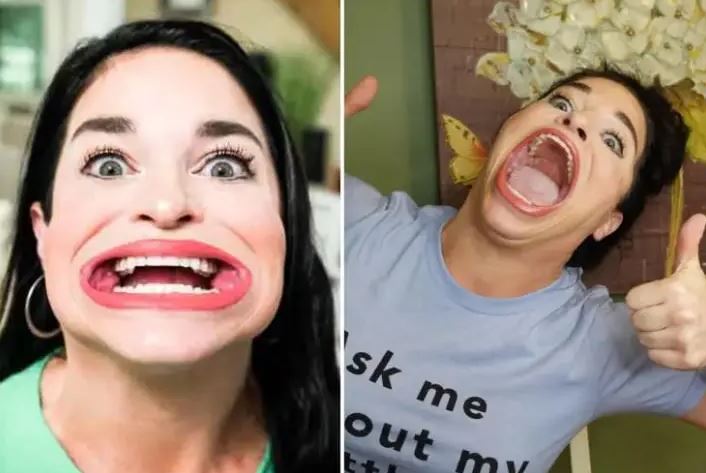 The woman with the widest mouth in the world earns $13,500 every time on TikTok 1