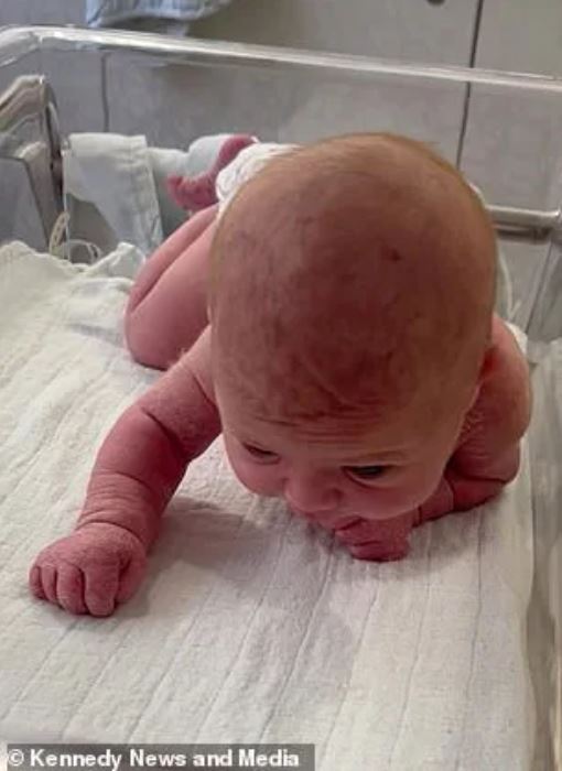 Mother astonished as newborn baby lifts head and crawls at just 3 days old 1