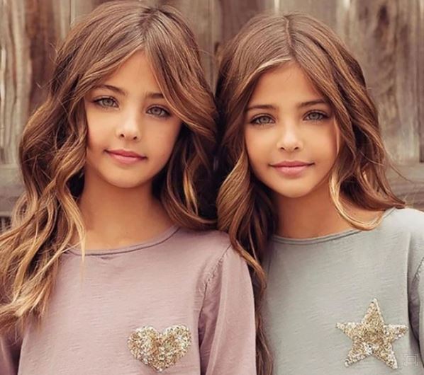 The most beautiful twin sisters in the world, possessing extraordinary looks after 13 years 2