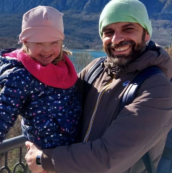 Gay single father adopts girl with Down syndrome and witnesses her incredible growth 7