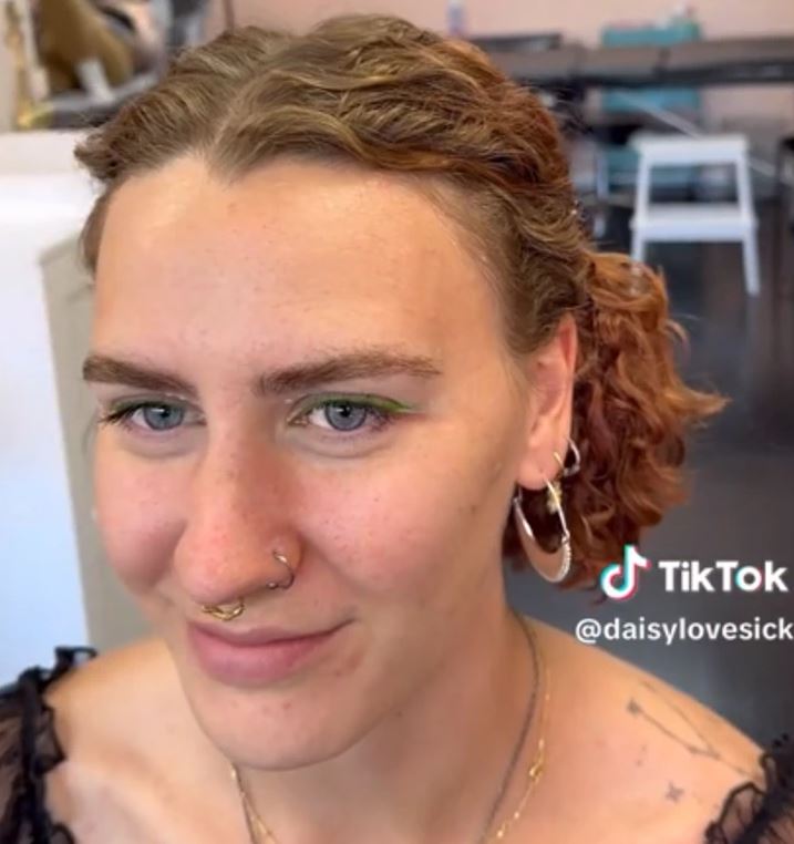 Internet divided over trend of tattooing 'permanent freckles' on the face 1