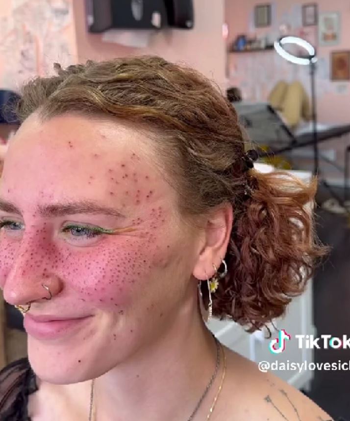 Internet divided over trend of tattooing 'permanent freckles' on the face 4