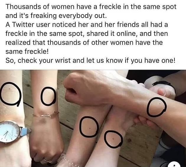 Why so many people have an 'identical' freckle in the exact same spot 1