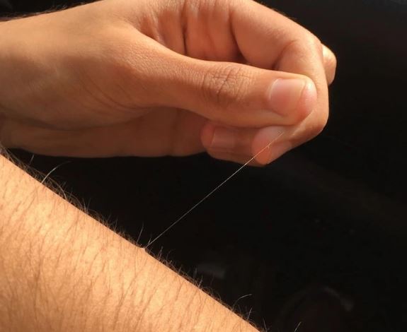 Your body hair can grow absurdly long, here’s why 2