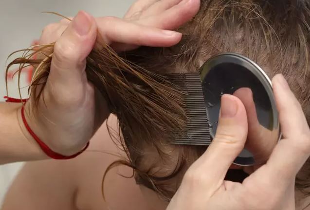 Vegan neighbor refuses to get rid of her child’s head lice because she's vegan 1