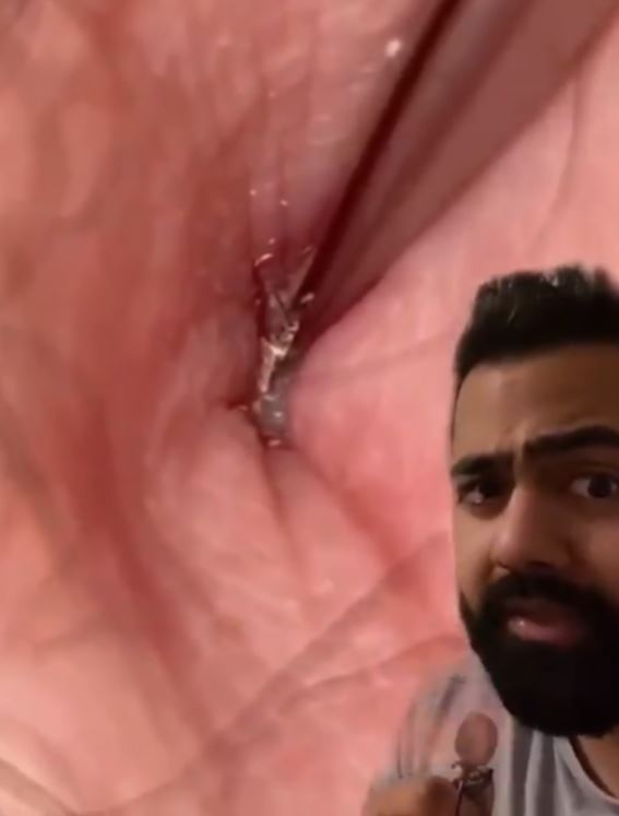 Here is the grim truth about not washing your belly button properly, Doctor reveals 1