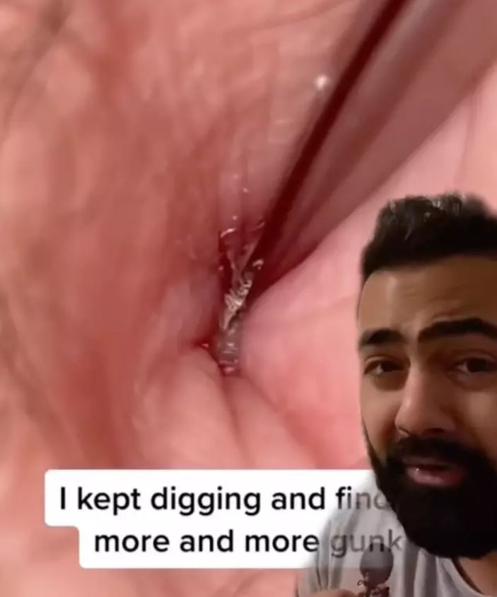 Here is the grim truth about not washing your belly button properly, Doctor reveals 2