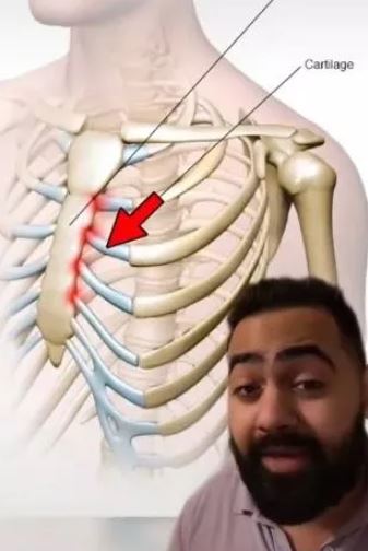 Doctor explains the reasons behind the random chest pains you get 2