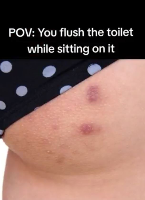 Doctor reveals the reason why you should NEVER flush the toilet while still sitting down 2