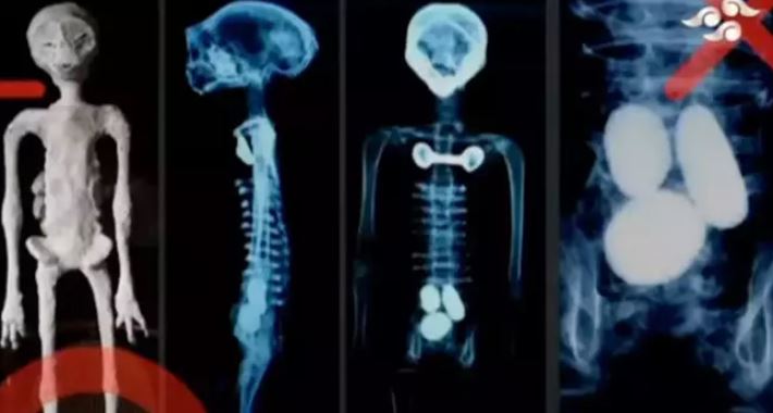'X-ray scans' of two 'alien bodies' released during the public hearing 6