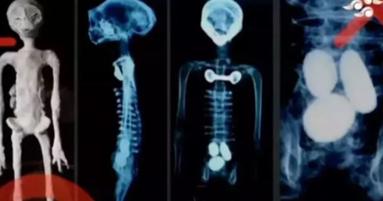 Disturbing 'truth' behind 'alien bodies' released after x-rayed 2