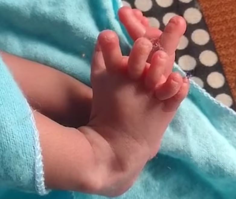 Baby born with 14 fingers and 12 toes hailed as ‘second coming of Hindu goddess’ 2