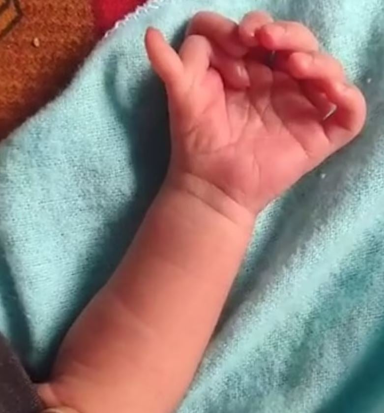 Baby born with 14 fingers and 12 toes hailed as ‘second coming of Hindu goddess’ 3