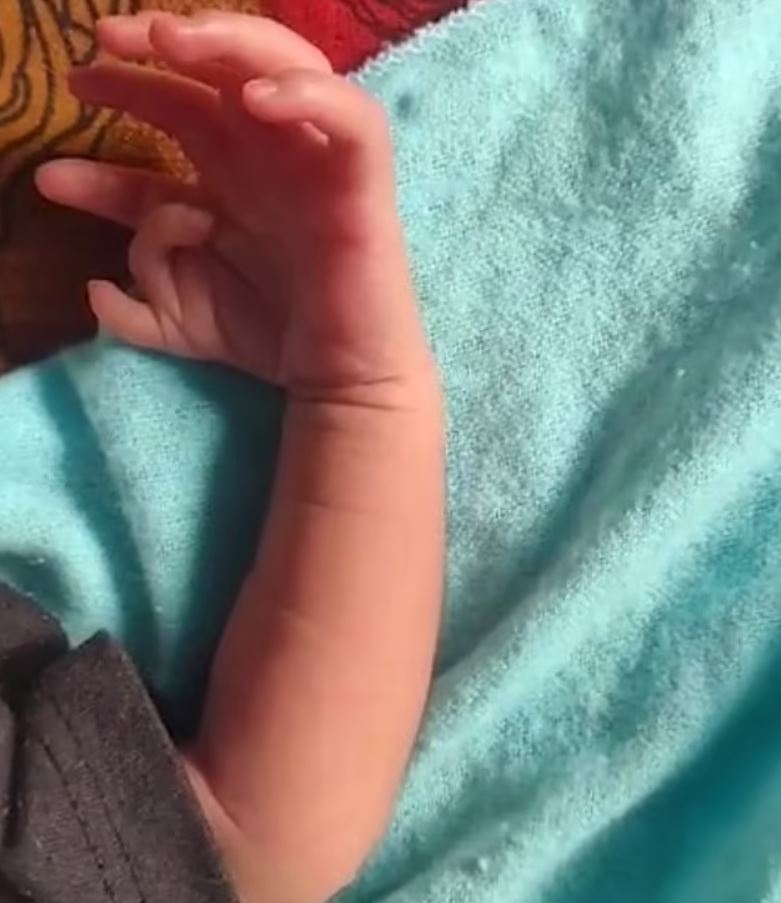 Baby born with 14 fingers and 12 toes hailed as ‘second coming of Hindu goddess’ 5