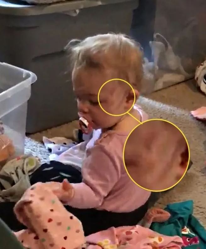 Couple stunned by spotting ghostly figure scratching their baby daughter at night 4