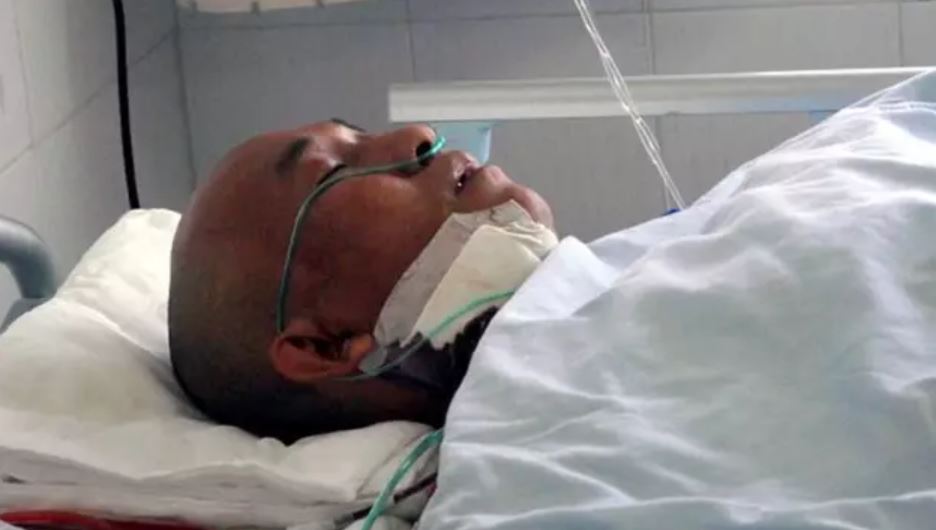 Doctor was stunned after discovering a knife in man's head for four years 1