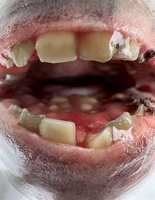 Fisherman stunned after catching ‘human teeth’, but daughter wants it for tooth fairy 4
