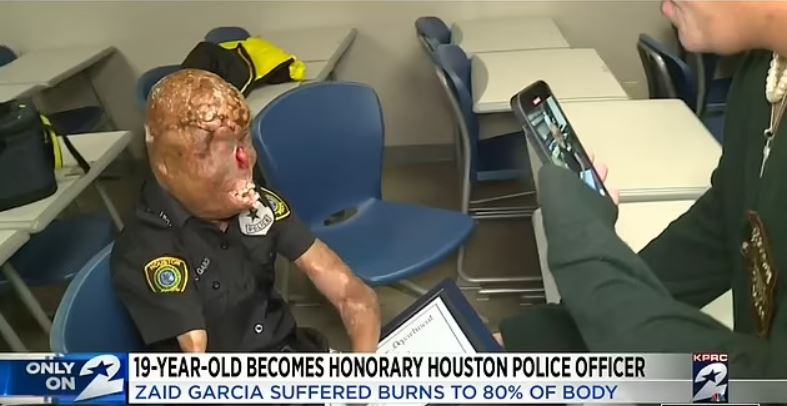 Teenager, 19, who miraculously survived burns to 80 percent of his body is made honorary police officer 3