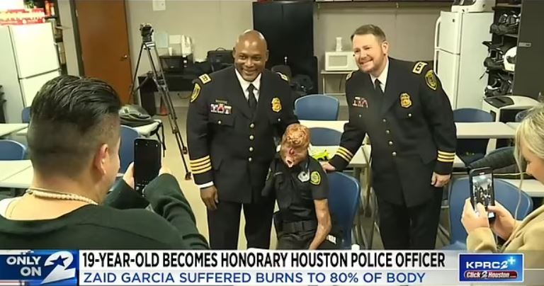 Teenager, 19, who miraculously survived burns to 80 percent of his body is made honorary police officer 4
