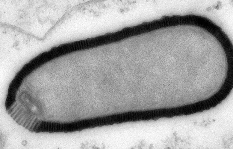 Researchers have warned ancient 'zombie' viruses frozen in permafrost for 50,000 years are thawing 2