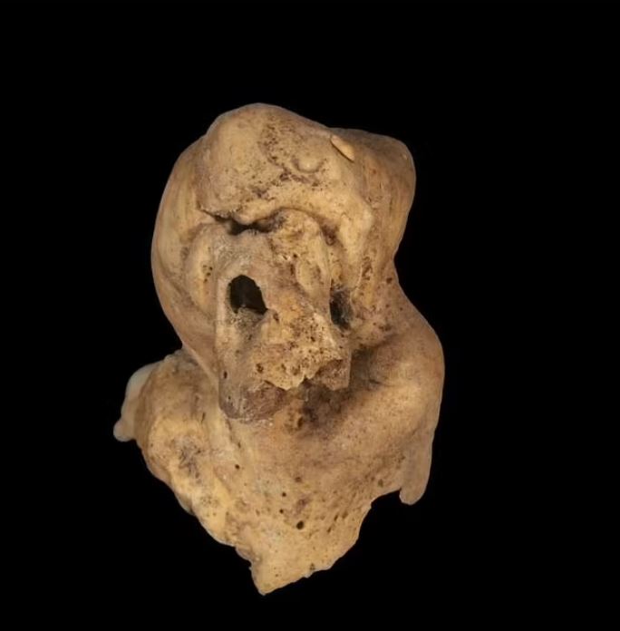Tumor with TEETH is unearthed in the remains of ancient Egyptian woman 2