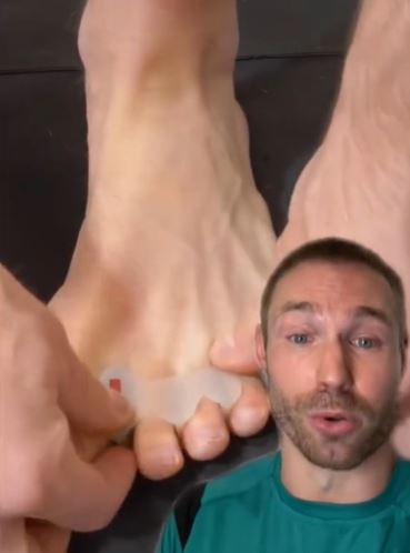 Expert reveals a clever trick that can banish nasty bunions 3