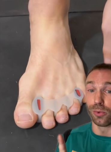 Expert reveals a clever trick that can banish nasty bunions 4