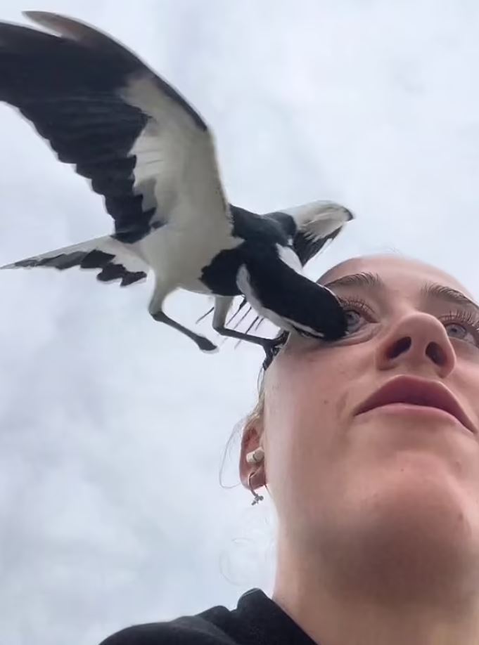 Woman almost loses an eye to swooping magpie 2