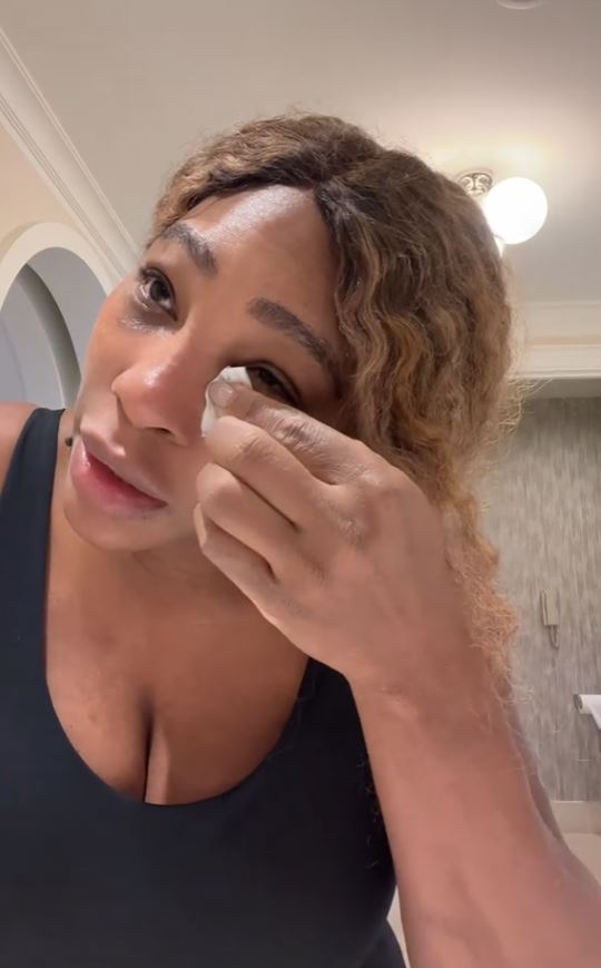 Serena Williams left fans BAFFLED after revealing she uses breast milk to help heal sunburn 3