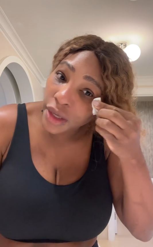 Serena Williams left fans BAFFLED after revealing she uses breast milk to help heal sunburn 4