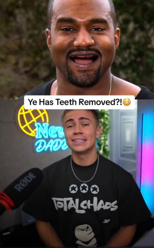 Tiktoker left stunned after explaining how Kanye West cleans his $850,000 titanium teeth 4