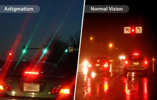 Symptoms include blurry vision, squinting, and headaches due to light improperly entering the eye.Image Credits: @r/interestingasf**k