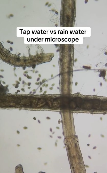 Viewers reacted with disgust to visible organisms like seed-like creatures and worms in the water samples. Image Credits: @microscope.vision/Tiktok