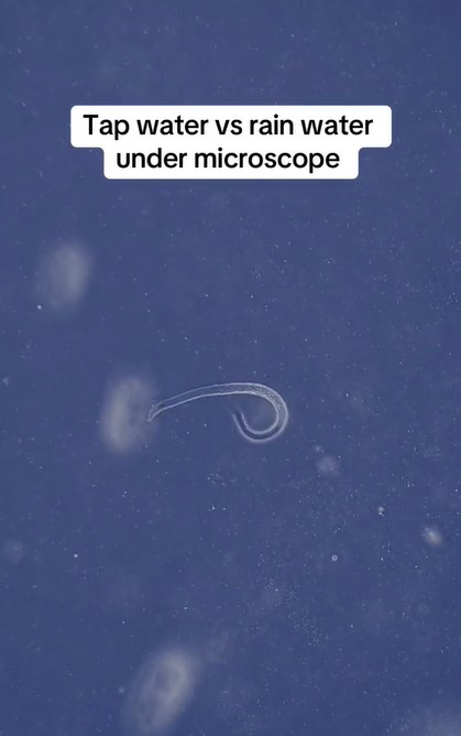 Comparisons between rainwater and tap water revealed both contain alarming microorganisms. Image Credits: @microscope.vision/Tiktok