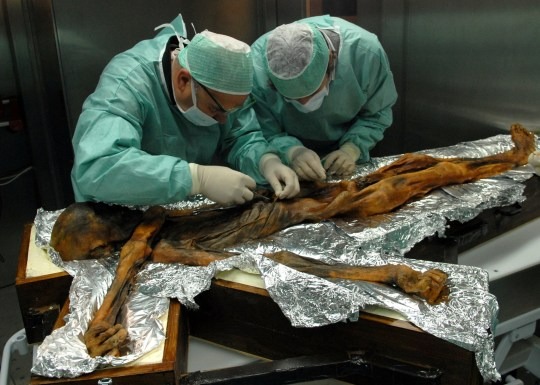 Ötzi the iceman finally reveals his face after 5,300 years 2